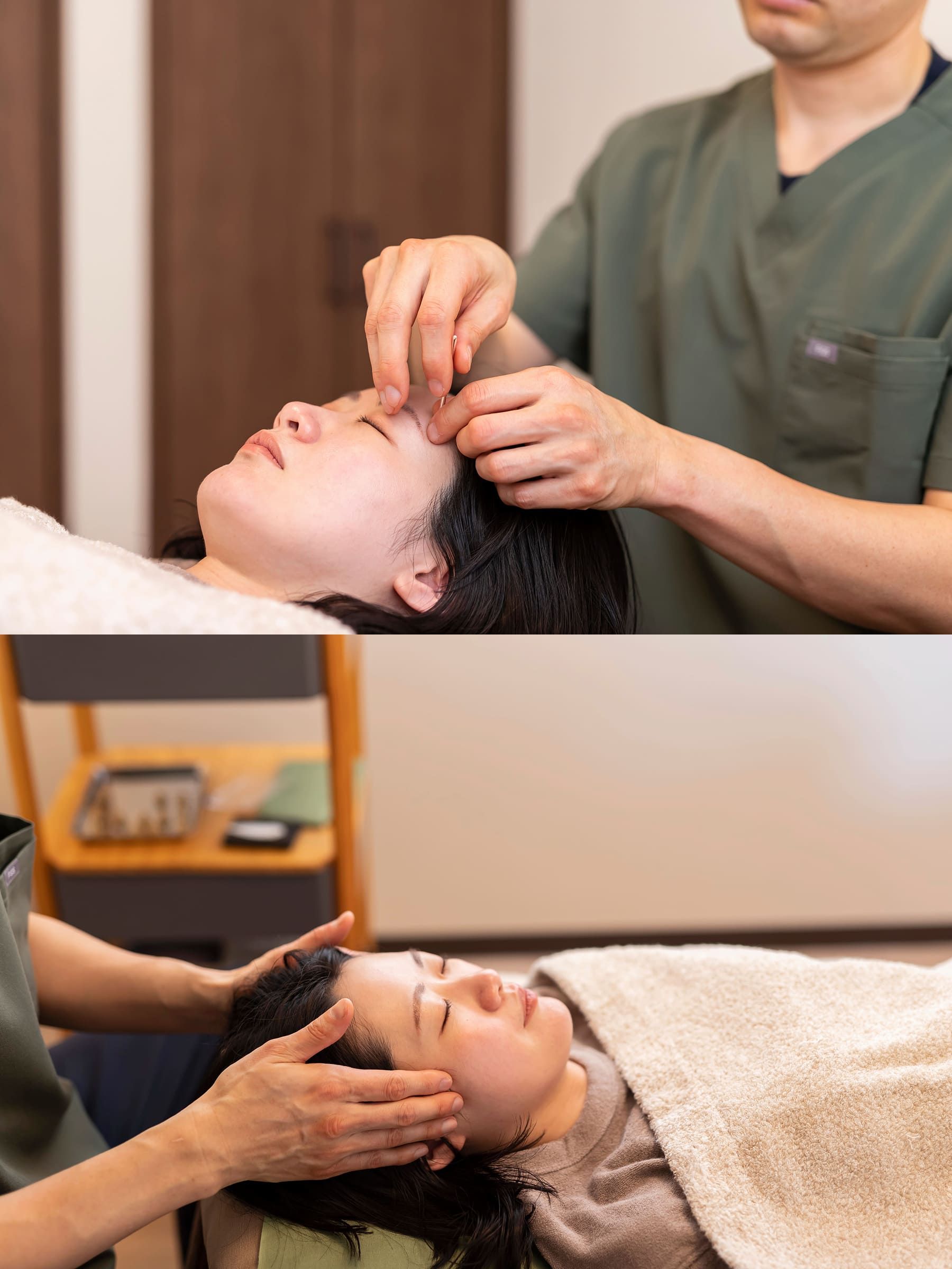 美容鍼コースの施術イメージ